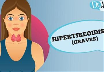 Hipertireoidismo, o que é?